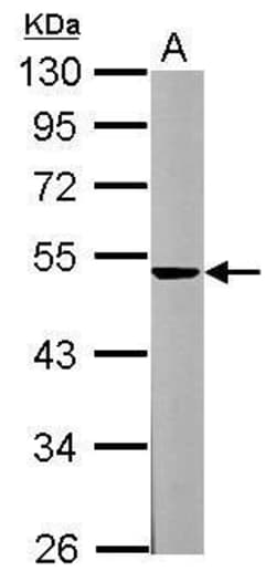 Invitrogen Spinesin Polyclonal Antibody 100 &mu;L | Buy Online | Invitrogen&trade; | Fisher Scientific