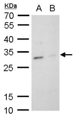 Invitrogen TPPP Polyclonal Antibody 100 &mu;L; Unconjugated:Antibodies,