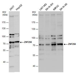 Invitrogen ZNF256 Polyclonal Antibody 100 &mu;L | Buy Online | Invitrogen&trade; | Fisher Scientific