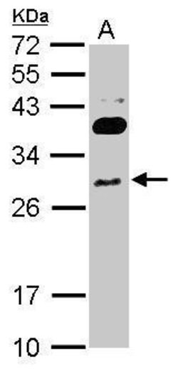 Invitrogen RNF166 Polyclonal Antibody 100 &mu;L; Unconjugated:Antibodies,
