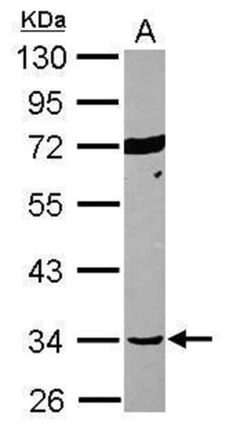 Invitrogen SEPT12 Polyclonal Antibody 100 &mu;L; Unconjugated:Antibodies,