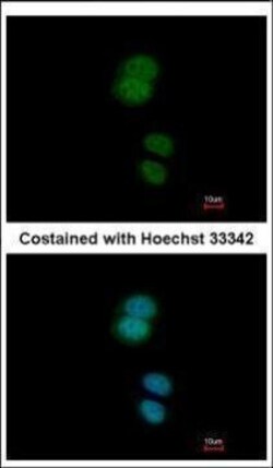 Invitrogen ZNF584 Polyclonal Antibody 100 &mu;L; Unconjugated:Antibodies,