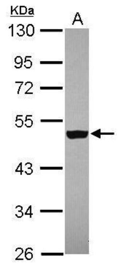 Invitrogen ZNF584 Polyclonal Antibody 100 &mu;L; Unconjugated:Antibodies,