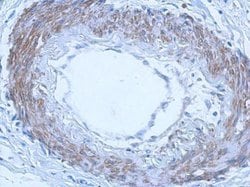 Invitrogen RGL4 Polyclonal Antibody 100 &mu;L; Unconjugated:Antibodies,