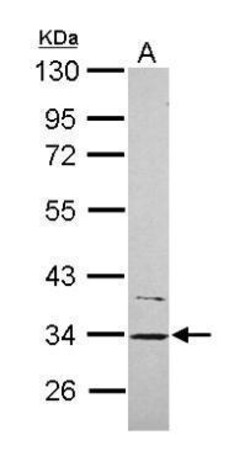 Invitrogen CYB5R1 Polyclonal Antibody 100 &mu;L; Unconjugated:Antibodies,