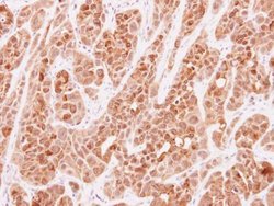 Invitrogen VLK Polyclonal Antibody 100 μL; Unconjugated:Antibodies,
