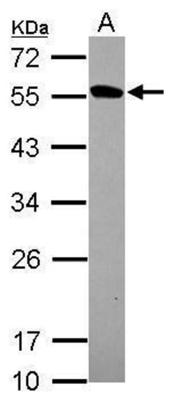 Invitrogen VLK Polyclonal Antibody 100 μL; Unconjugated:Antibodies,