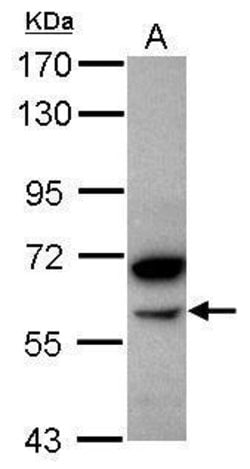Invitrogen alpha Amylase 2B Polyclonal Antibody 100 μL; Unconjugated:Antibodies,