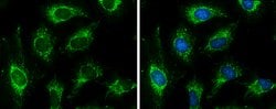 Invitrogen PDHB Polyclonal Antibody 100 &mu;L; Unconjugated:Antibodies,
