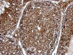 Invitrogen PDHB Polyclonal Antibody 100 &mu;L; Unconjugated:Antibodies,
