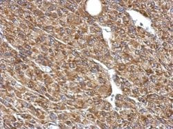 Invitrogen PDHB Polyclonal Antibody 100 &mu;L; Unconjugated:Antibodies,