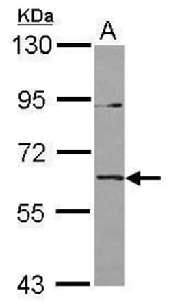 Invitrogen IL1RL2 Polyclonal Antibody 100 &mu;L | Buy Online | Invitrogen&trade; | Fisher Scientific