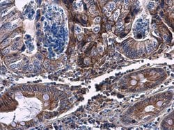 Invitrogen CHST4 Polyclonal Antibody 100 &mu;L; Unconjugated:Antibodies,