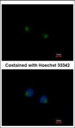 Invitrogen MGAT4A Polyclonal Antibody 100 &mu;L | Buy Online | Invitrogen&trade; | Fisher Scientific