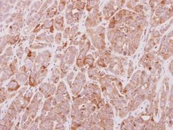 Invitrogen MGAT4A Polyclonal Antibody 100 &mu;L | Buy Online | Invitrogen&trade; | Fisher Scientific