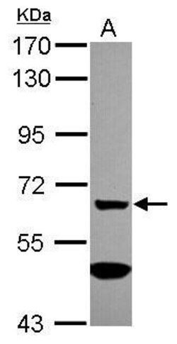 Invitrogen MGAT4A Polyclonal Antibody 100 &mu;L | Buy Online | Invitrogen&trade; | Fisher Scientific