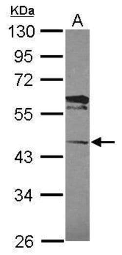 Invitrogen LACC1 Polyclonal Antibody 100 &mu;L | Buy Online | Invitrogen&trade; | Fisher Scientific