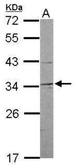 Invitrogen NRBF2 Polyclonal Antibody 100 &mu;L; Unconjugated:Antibodies,