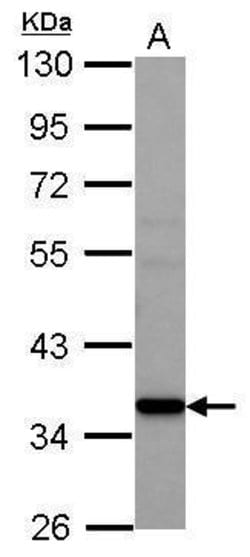 AMD1 Polyclonal Antibody, Invitrogen 100 &mu;L; Unconjugated:Antibodies,