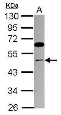 Invitrogen TRIP13 Polyclonal Antibody 100 &mu;L; Unconjugated:Antibodies,