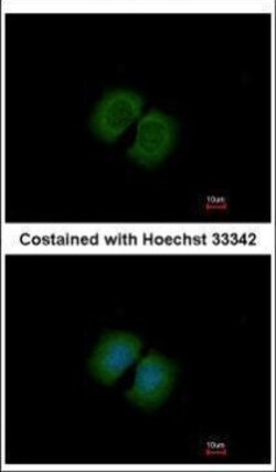 Invitrogen PCDHA12 Polyclonal Antibody 100 μL; Unconjugated:Antibodies,