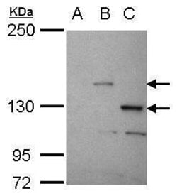 Invitrogen STK31 Polyclonal Antibody 100 &mu;L; Unconjugated:Antibodies,