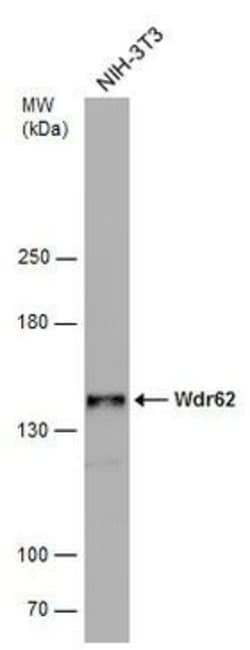 Invitrogen WDR62 Polyclonal Antibody 100 &mu;L; Unconjugated:Antibodies,