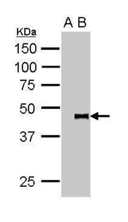 Invitrogen PYGO2 Polyclonal Antibody 100 &mu;L; Unconjugated:Antibodies,
