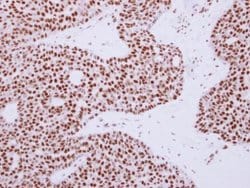 Invitrogen RAD50 Polyclonal Antibody 100 &mu;L; Unconjugated:Antibodies,