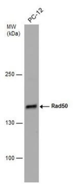 Invitrogen RAD50 Polyclonal Antibody 100 &mu;L; Unconjugated:Antibodies,