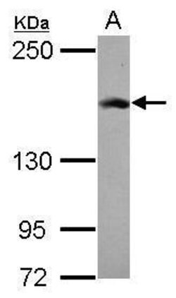 Invitrogen RAD50 Polyclonal Antibody 100 &mu;L; Unconjugated:Antibodies,