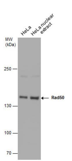 Invitrogen RAD50 Polyclonal Antibody 100 &mu;L; Unconjugated:Antibodies,