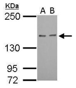 Invitrogen RAD50 Polyclonal Antibody 100 &mu;L; Unconjugated:Antibodies,