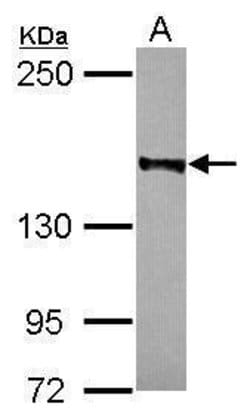 Invitrogen RAD50 Polyclonal Antibody 100 &mu;L | Buy Online | Invitrogen&trade; | Fisher Scientific