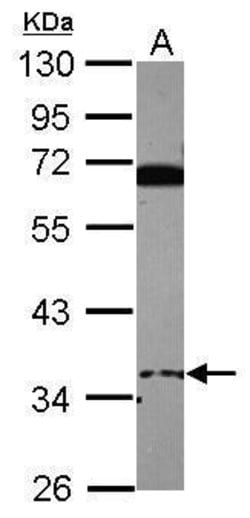 Invitrogen EID3 Polyclonal Antibody 100 &mu;L; Unconjugated:Anticorps,