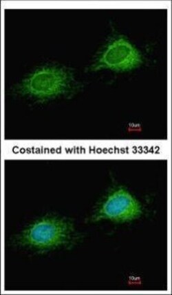 Invitrogen PITRM1 Polyclonal Antibody 100 &mu;L; Unconjugated:Antibodies,