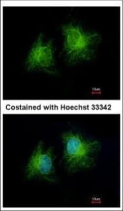 Invitrogen CCDC28B Polyclonal Antibody 100 &mu;L; Unconjugated:Antibodies,