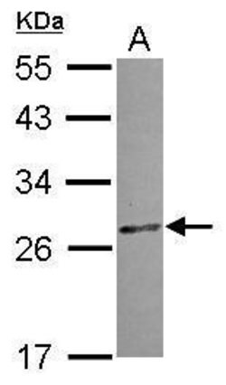 Invitrogen CCDC28B Polyclonal Antibody 100 &mu;L; Unconjugated:Antibodies,