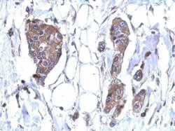 Invitrogen DDX59 Polyclonal Antibody 100 &mu;L; Unconjugated:Antibodies,