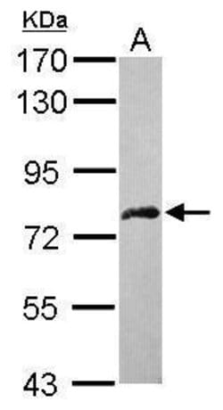 Invitrogen DDX59 Polyclonal Antibody 100 &mu;L; Unconjugated:Antibodies,