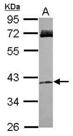 Invitrogen RASSF4 Polyclonal Antibody 100 &mu;L | Buy Online | Invitrogen&trade; | Fisher Scientific
