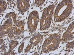 Invitrogen EPLIN Polyclonal Antibody 100 &mu;L; Unconjugated:Antibodies,
