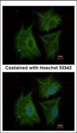 Invitrogen AGBL4 Polyclonal Antibody 100 &mu;L; Unconjugated:Antibodies,