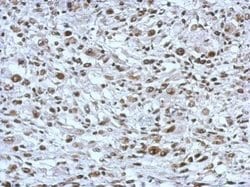 Invitrogen THAP11 Polyclonal Antibody 100 &mu;L; Unconjugated:Antibodies,