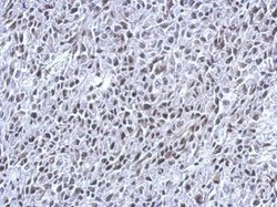 Invitrogen THAP11 Polyclonal Antibody 100 &mu;L; Unconjugated:Antibodies,