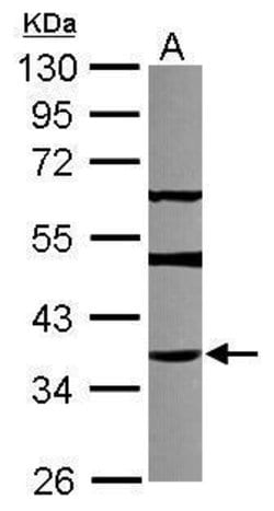 Invitrogen THAP11 Polyclonal Antibody 100 &mu;L; Unconjugated:Antibodies,
