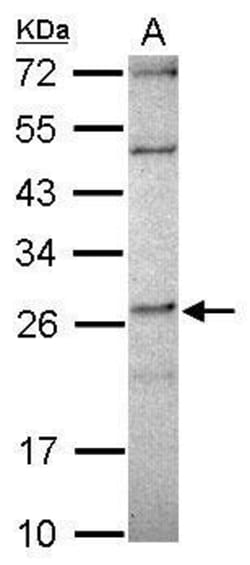 Invitrogen DPCD Polyclonal Antibody 100 &mu;L | Buy Online | Invitrogen&trade; | Fisher Scientific