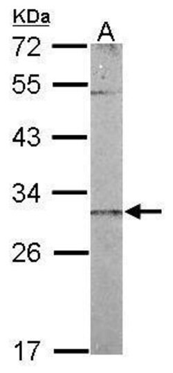 Invitrogen CHCHD3 Polyclonal Antibody 100 &mu;L; Unconjugated:Antibodies,