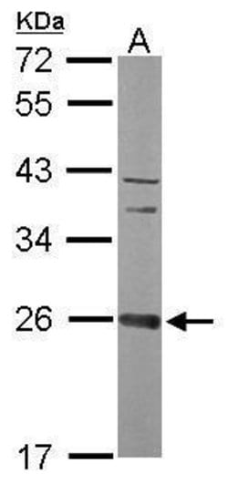Invitrogen CCDC90B Polyclonal Antibody 100 &mu;L; Unconjugated:Antibodies,