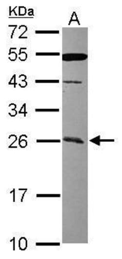 Invitrogen CCDC90B Polyclonal Antibody 100 &mu;L; Unconjugated:Antibodies,